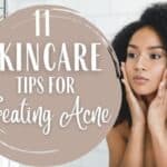 Skin care tips for acne skin