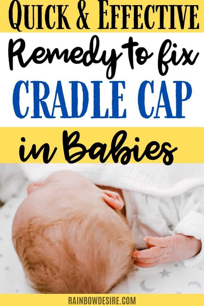 Cradle Cap Most Effective Remedy To Treat Cradle Cap Fast Rainbow