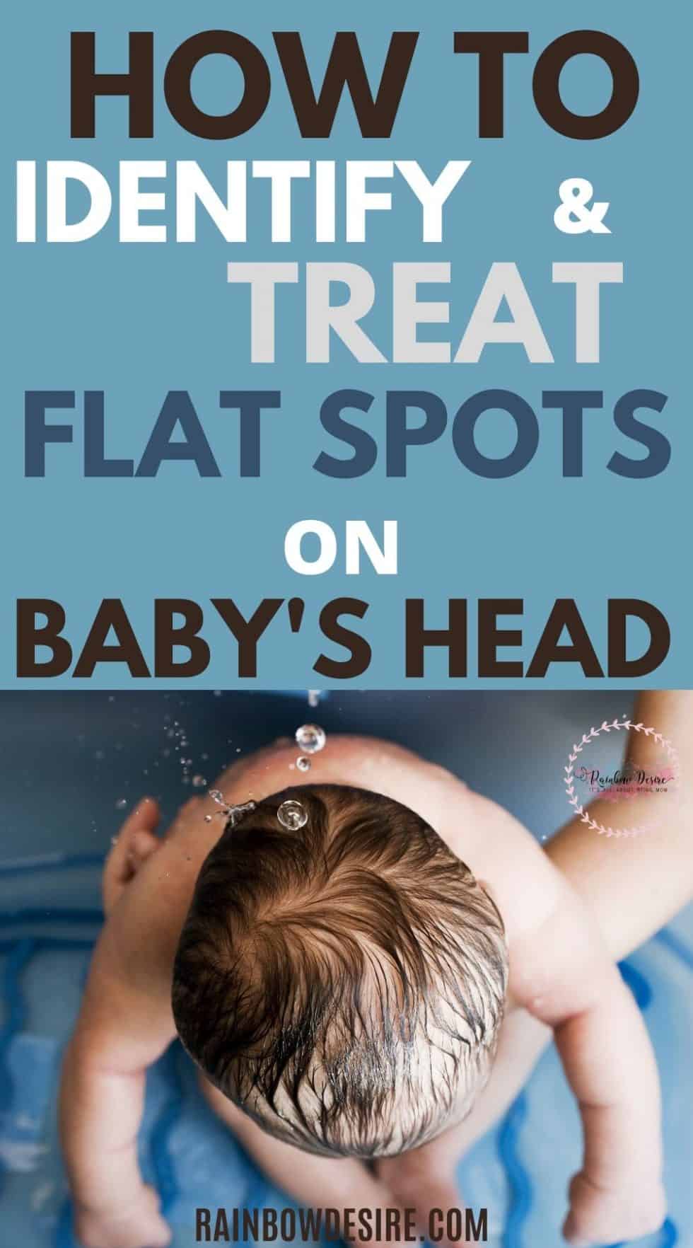 Flat Head Syndrome in babies How to identify flat spots on baby's