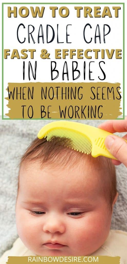 A mom combing baby's scalp to get rid of cradle cap. 