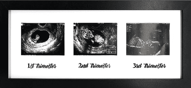 three trimesters sonogram picture frame for first time parents to be 